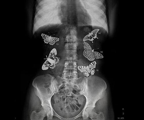 butterflies-in-stomach.jpg